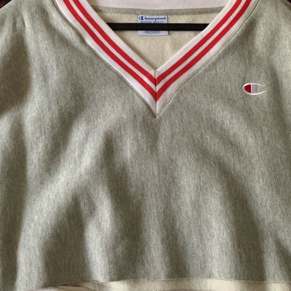 Champion Set - Picture 4 of 5